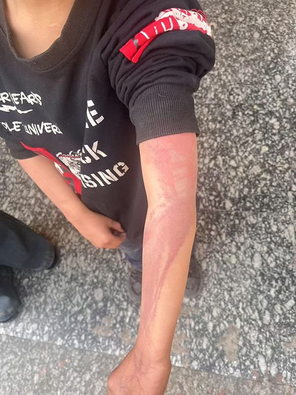 晟红网 邵阳一男童遭虐待致轻伤二级：生父已被刑拘，检察院提前介入_大皖新闻 | 安徽网